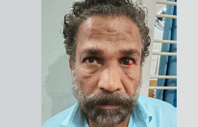 കല്ലൂർ ഹൈവേ കൊള്ളസംഘത്തെ സഹായിച്ച  പാടിച്ചിറ സ്വദേശിയെ പൊലീസ് പിടികൂടി