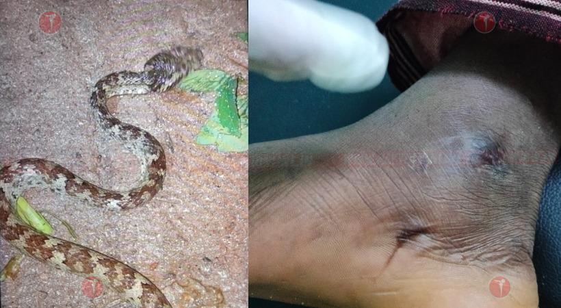 വീണ്ടും പാമ്പ് ഭീതി; കോഴിക്കോട് യുവാവിന് പാമ്പുകടിയേറ്റു